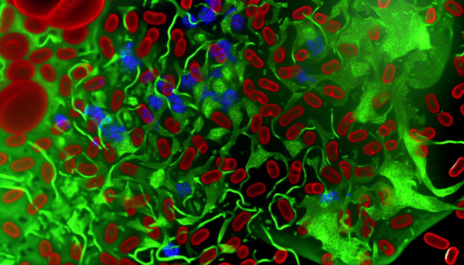 Ny oppdagelse: Mikroklumper i blodet kan forklare Long COVID-symptomer